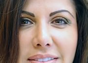 rhinoplasty-plastic-surgery-nose-job-los-angeles-woman-after-front-dr-maan-kattash2